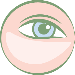 سرم دور چشم